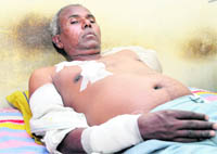 Puran Das who was attacked by a leopard at Clement Town in Dehradun on Friday.