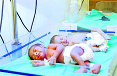 Premature babies at the Doon Hospital (Female) in Dehradun