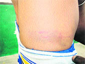 The injury marks visible on the body of one of the students. 