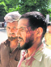 Injured Nazir Ahmed at the GMCH in Jammu