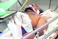 A seriously wounded Assistant Sub Inspector Gurdial Singh lying unconscious at the DMCH, where he is being treated, in Ludhiana 