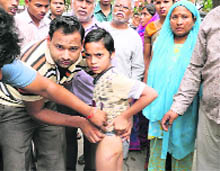 The father of the child shows wounds on the leg of Ankit in front of the school in Ludhiana.