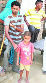 Residents of Arnetu village in Patiala district who are suffering from physical deformities