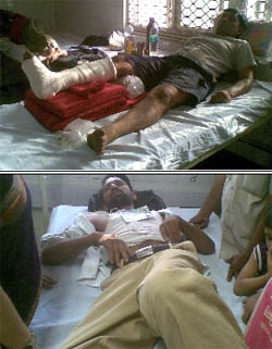 Some of those injured in the police crackdown. 