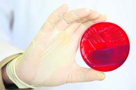 A petri dish with colonies of the virulent E coli bacteria