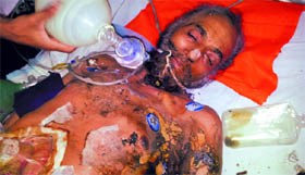The burnt body of Ghinder Singh.