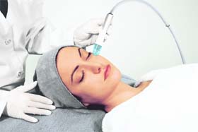 Touch of science: Try new treatments such as micro-dermabrasion