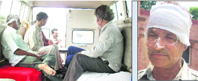 The injured being taken to the NFL Hospital at Nangal on Saturday and (right) one of the injured workers