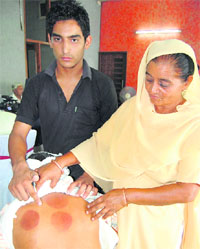 Avinash Rani and her son Deepak Kumar show the scars on the back of Kamaljit Sharma (husband of Avinash) in Amritsar on Sunday. Photo: Vishal Kumar