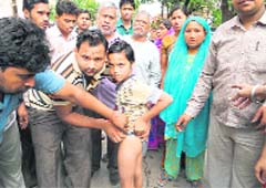 Ankit shows injury marks in front of his school in Ludhiana.