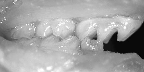 This handout photo shows a bioengineered tooth (right) engrafted into the lower jaw of a mouse at Tokyo University of Science. Scientists in Japan said they had created teeth by using mouse stem cells and successfully transplanted them into mice