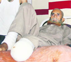 Mohammad Hussain (60) of Shahpur village was cutting bushes when a landmine ripped through his left leg