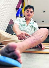 Dreams shattered Gurcharan Singh shows his injury marks in Ludhiana