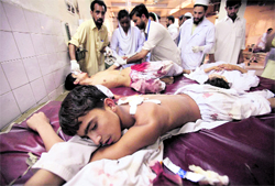 Doctors treat children injured in the attack in Peshawar on Tuesday
