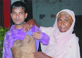 The mother of Vinod Kumar showing the injury marks that her son sustained in the bomb blast that took place on February 8, 1992, in Bathinda