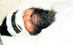 One of the injured at a hospital in Amritsar on Friday.