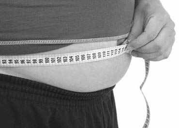 Weight-loss surgery