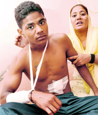 Ajay Kumar flanked by his mother after he was injured in an assault by a group of youths in Sector 52, Chandigarh, on Saturday