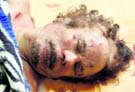 The corpse of Muammar Gaddafi