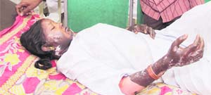 Kamlesh Kumari undergoing treatment at a hospital in Jalandhar on Thursday.