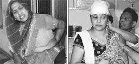 Two of the women injured in an attack at the Triveni temple in Sector 10 of Panchkula on Saturday