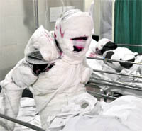 One of the injured being treated at the DMCH in Ludhiana on Wednesday