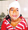 The girl who was injured by a leopard in Pithoragarh.