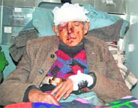 Farmer Manchand who was injured by a bear in the Katola jungle of Mandi