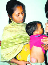 A woman shows the burn injuries which Chirag got at Ashreya in Chandigarh on Sunday. 