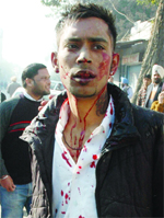 Injured Bharat Bhusan Lovely after the clash.