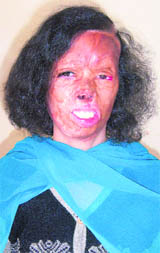 Suman Kaushal, a fire victim 