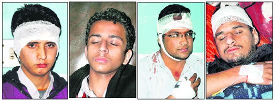 The injured admitted to the Civil Hospital in Jalandhar on Friday.