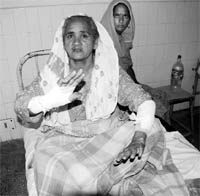 An injured woman of village Gobindpura, at Budhlada civil hospital, undergoing treatment.