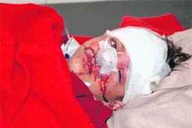 An injured child at a hospital