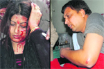 Fiza after being injured in a clash with her neighbours in Sector 48, Mohali, on Wednesday; and (right) her injured neighbour Sanjay Aggarwal.