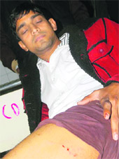 A dog bite vicitm admitted to the Civil Hospital. 