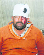 A migrant labourer, who got injured in a clash, undergoes treatment at the Civil Hospital in Jalandhar on Wednesday.