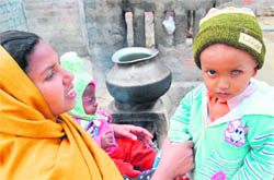 Three-year-old Jaskaran, who has eye cancer, with his mother at Fatehgarh Channa village in Sangrur. 