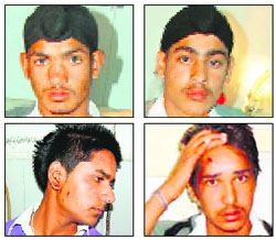 The students who were injured in a shooting incident in Bhangali Kala village near Amritsar. 