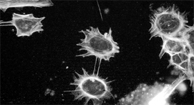 Three persons are the first wave of patients to receive controversial transplants of embryonic cells as part of an ambitious attempt to treat a range of incurable diseases with stem cell