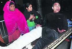 One of the injured motorcylists at the Government Multi-Specialty Hospital, Sector 16, Chandigarh, on Sunday night