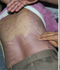 The injury marks on the body of Chamkaur Singh substantiate that it is not the case of a natural death, as the police claims. 