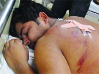 Sunil Kumar recuperating at hospital. 