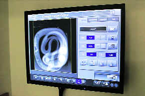 An X-ray shows the golf balls in the reptiles body