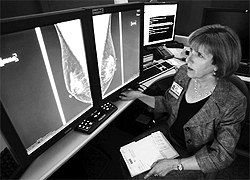 A doctor examines a mammograph of a breast cancer patient