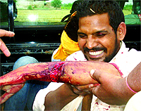 A student of an engineering college after being attacked with a sharp-edged weapon near Faridkot on Tuesday