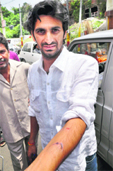Youth Congress leader Varinder Chib shows an injury mark in Jammu on Thursday.