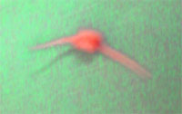 The fish bone removed from the food pipe of a patient.
