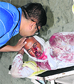 One of the injured at the trauma centre of the Civil Hospital in Karnal on Thursday