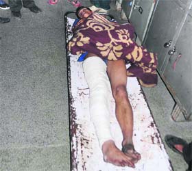 Ravi Thakur under treatment at the Indira Gandhi Medical College and Hospital in Shimla on Thursday